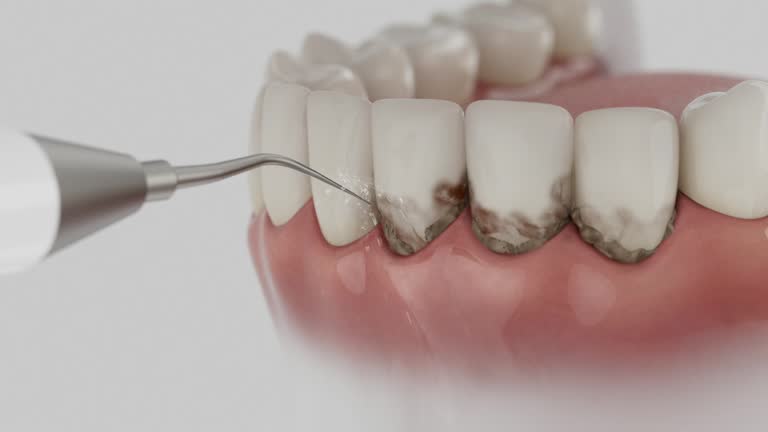 Reliable Wisdom Tooth Removal contractor in Warren County County, OH by Dentist Open Now